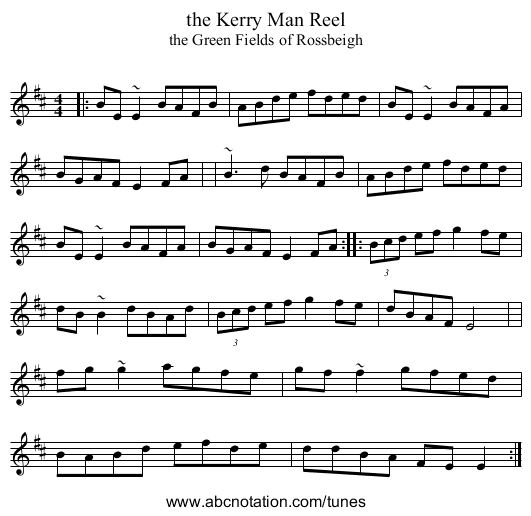 the Kerry Man Reel - staff notation