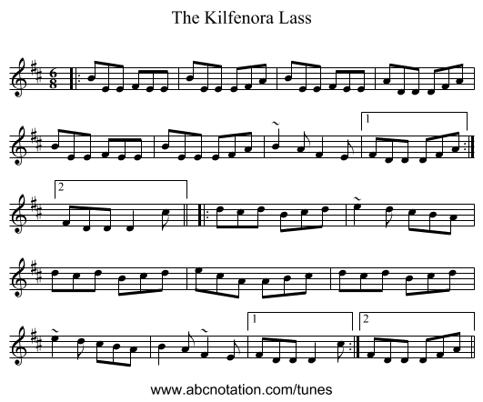 The Kilfenora Lass - staff notation