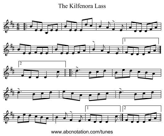 The Kilfenora Lass - staff notation