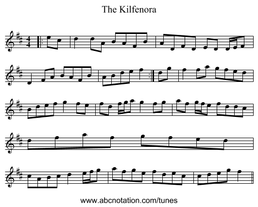 The Kilfenora - staff notation