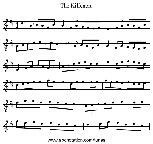 The Kilfenora - staff notation