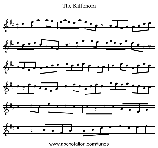 The Kilfenora - staff notation