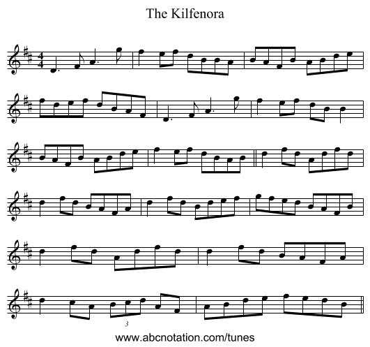 The Kilfenora - staff notation