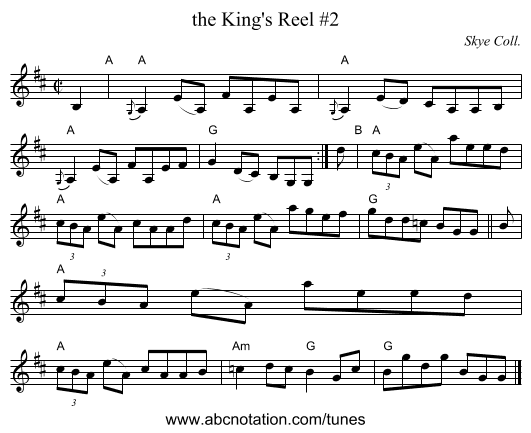 the King's Reel #2 - staff notation