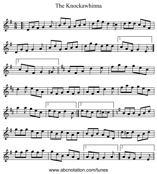 The Knockawhinna - staff notation