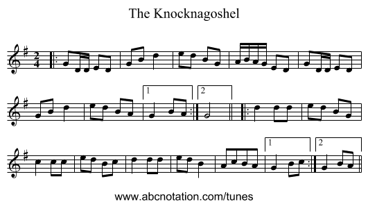 The Knocknagoshel - staff notation