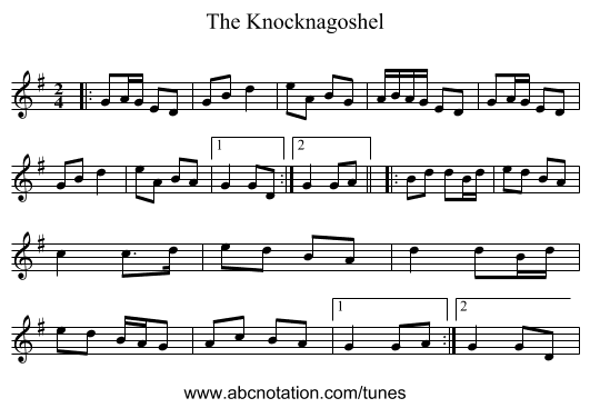 The Knocknagoshel - staff notation