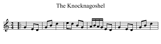 The Knocknagoshel - staff notation