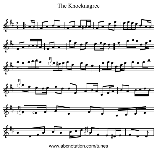 The Knocknagree - staff notation