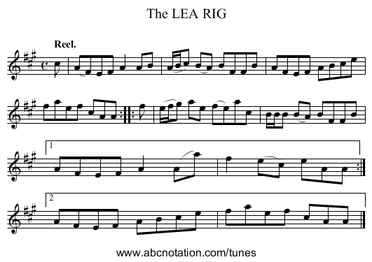 The LEA RIG - staff notation
