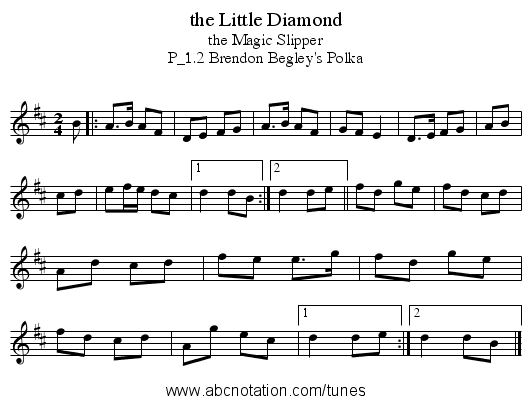 the Little Diamond - staff notation