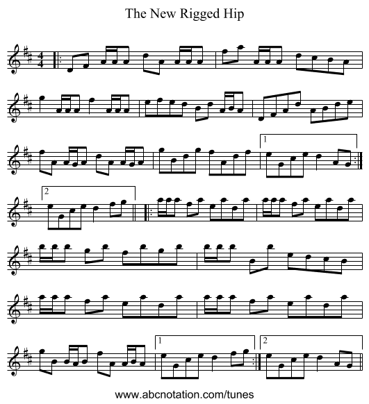 The New Rigged Hip - staff notation