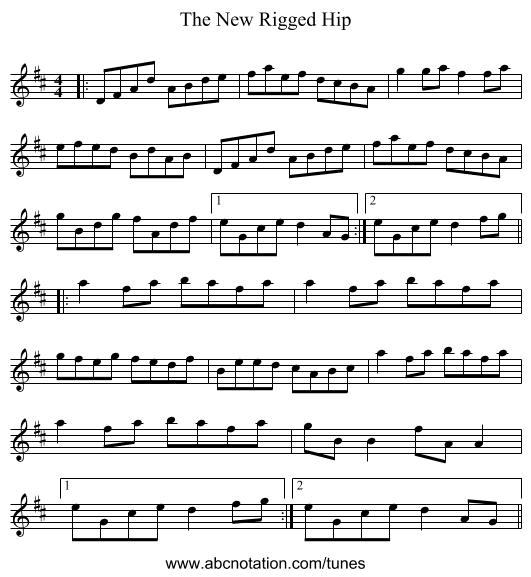The New Rigged Hip - staff notation