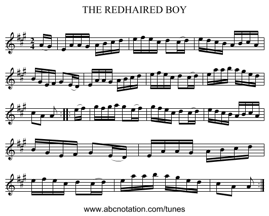 THE REDHAIRED BOY - staff notation