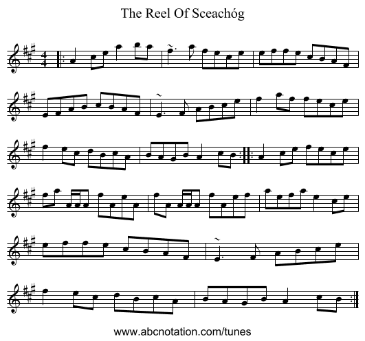 The Reel Of Sceachóg - staff notation