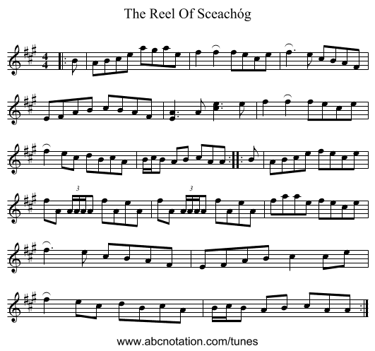 The Reel Of Sceachóg - staff notation