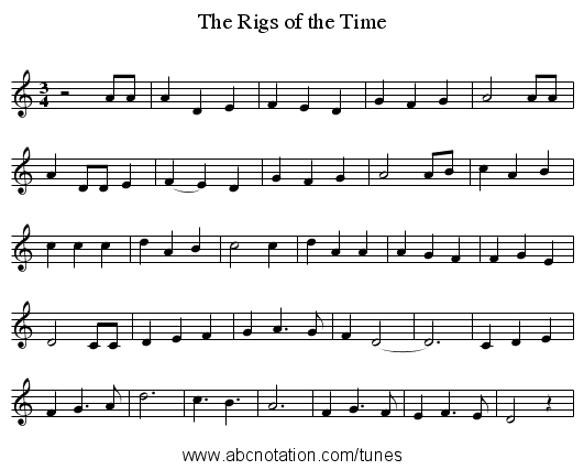 The Rigs of the Time - staff notation