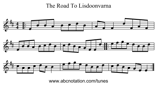 The Road To Lisdoonvarna - staff notation