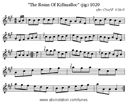The Ruins Of Killmalloc (jig) 1029 - staff notation