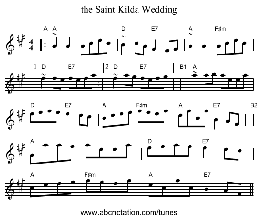 the Saint Kilda Wedding - staff notation