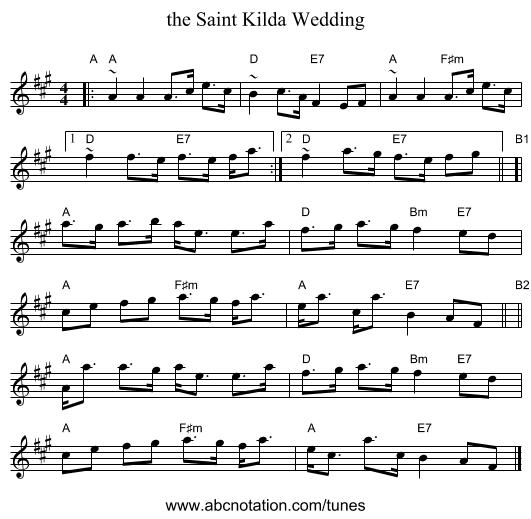 the Saint Kilda Wedding - staff notation