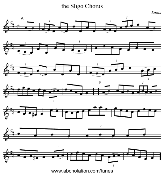 the Sligo Chorus - staff notation