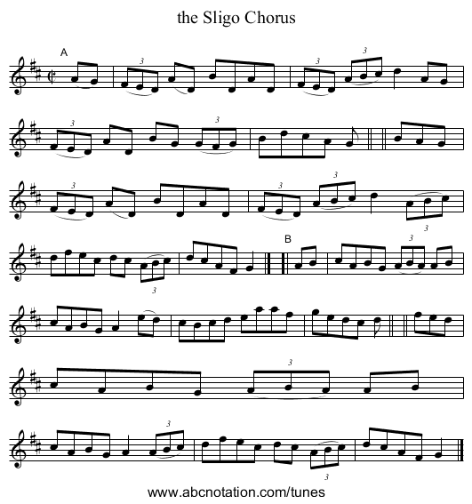 the Sligo Chorus - staff notation