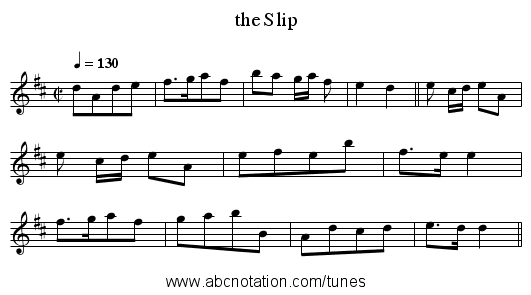 the Slip - staff notation