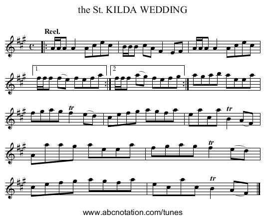 the St. KILDA WEDDING - staff notation
