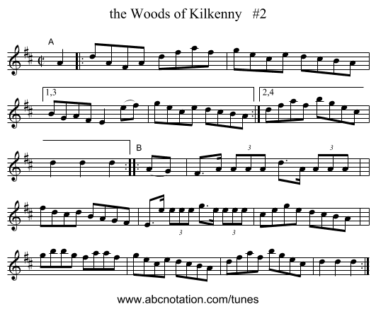the Woods of Kilkenny #2 - staff notation