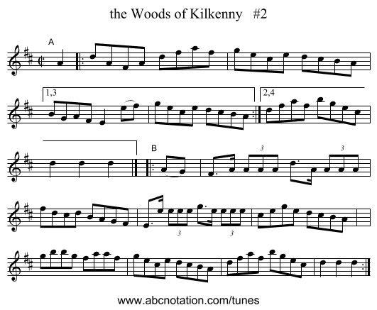 the Woods of Kilkenny   #2 - staff notation
