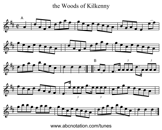 the Woods of Kilkenny - staff notation
