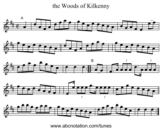 the Woods of Kilkenny - staff notation