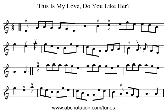 This Is My Love, Do You Like Her? - staff notation