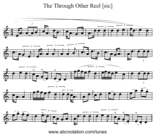 Through Other Reel [sic], The - staff notation