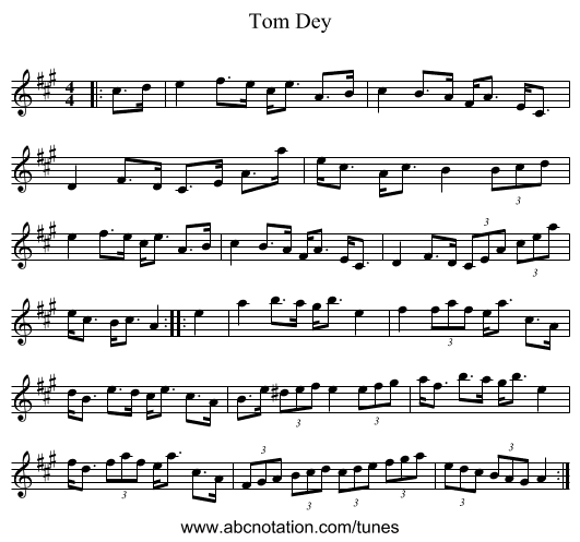 Tom Dey - staff notation