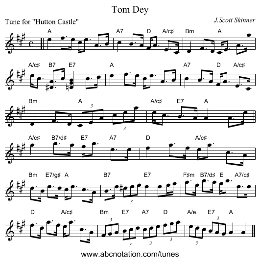 Tom Dey - staff notation