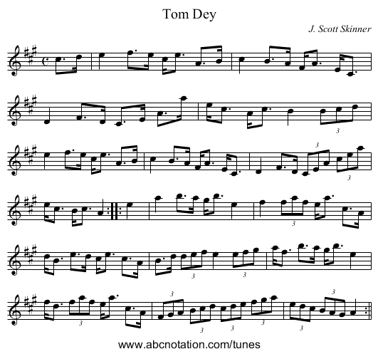 Tom Dey - staff notation