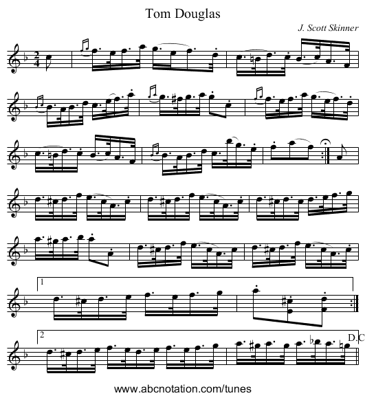 Tom Douglas - staff notation