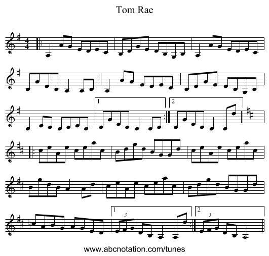 Tom Rae - staff notation