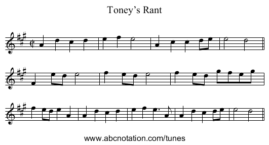 Toney’s Rant - staff notation