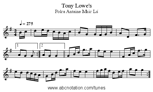Tony Lowe's - staff notation