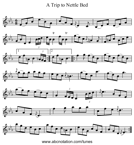 Trip to Nettle Bed, A - staff notation