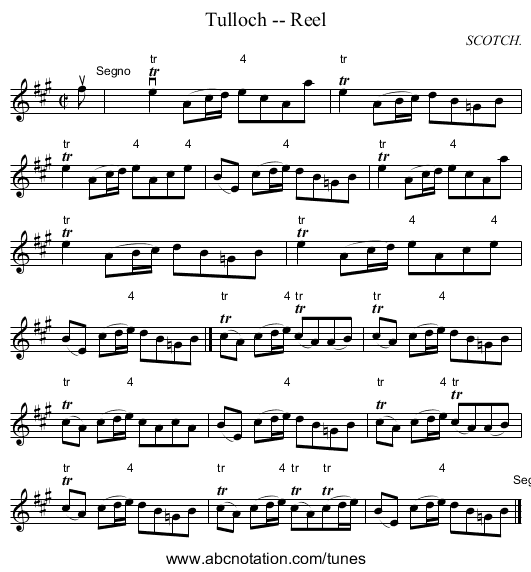 Tulloch -- Reel - staff notation