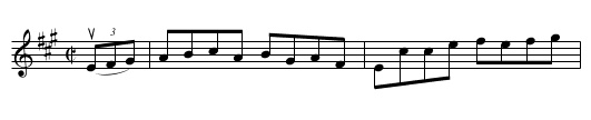 Turnpike -- Reel - staff notation