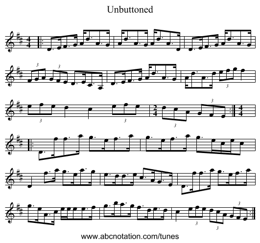 Unbuttoned - staff notation