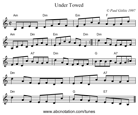 Under Towed - staff notation
