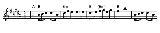 Unzer Toyrele [B] - staff notation