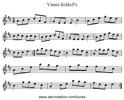 Vinnie Kilduff's - staff notation
