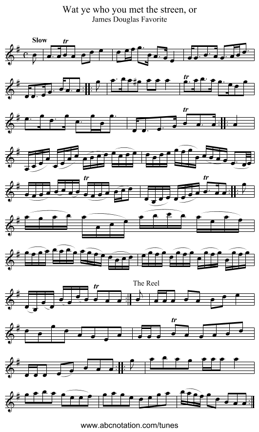 Wat ye who you met the streen, or - staff notation